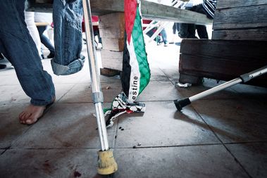 Polovica otrok na rehabilitaciji v Ljubljani je amputirancev.